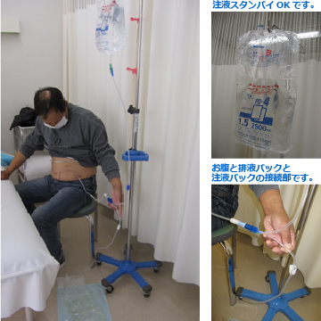 川島病院 腹膜透析の手順8