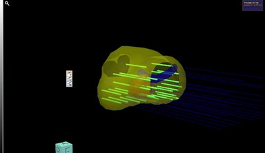 車のバックモニターのような仕組み